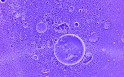 Améloblastome