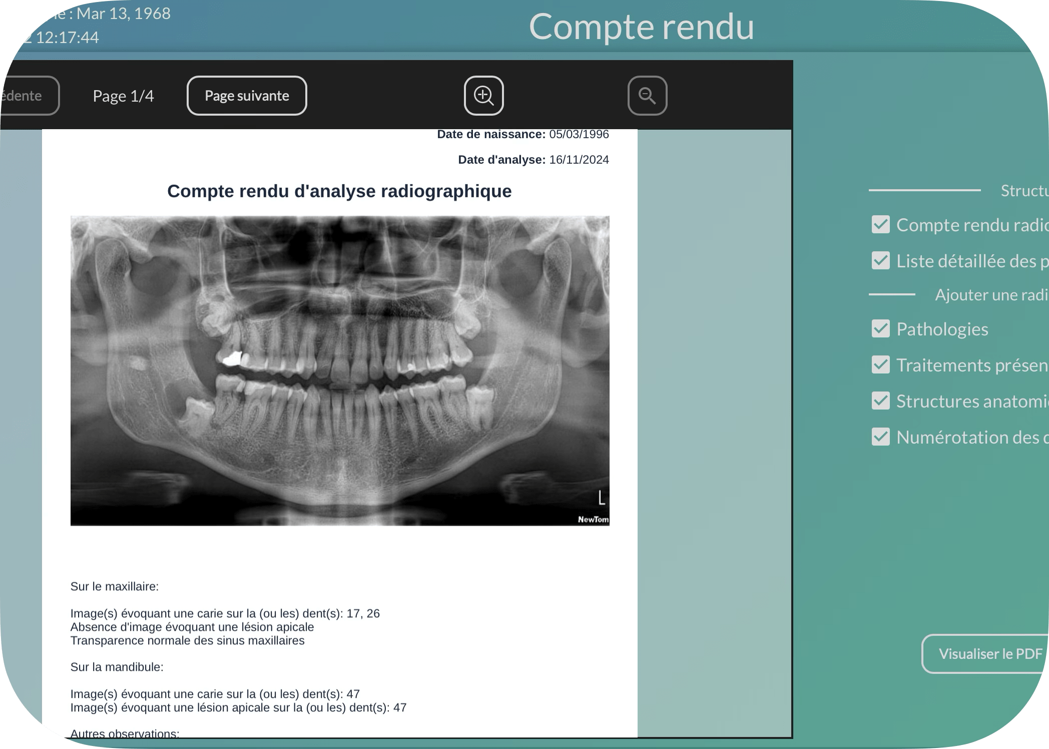 compte-rendu